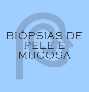 BIÓPSIAS DE PELE E MUCOSA