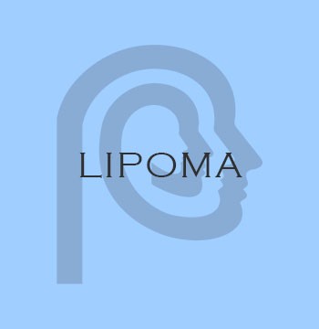 LIPOMA