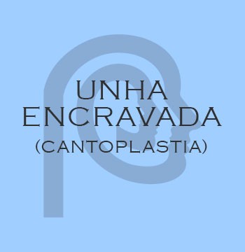 UNHA ENCRAVADA (cantoplastia)